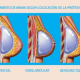 Aumento-de-pecho-lugar-de-colocacion-de-las-protesis-ventajas-e-inconvenientes