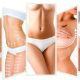 que-es-la-lipoabdominoplastia