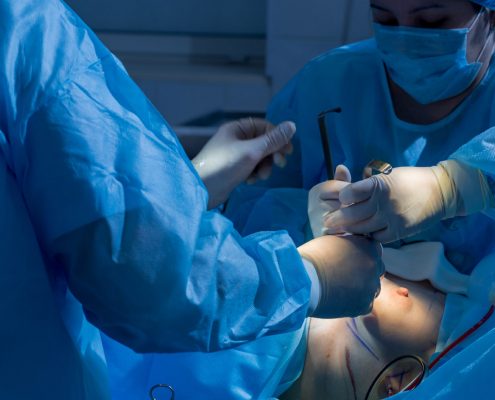 Surgeons team working with Monitoring of patient in surgical operating room. close-up breast augmentation