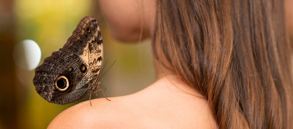 piel de mariposa