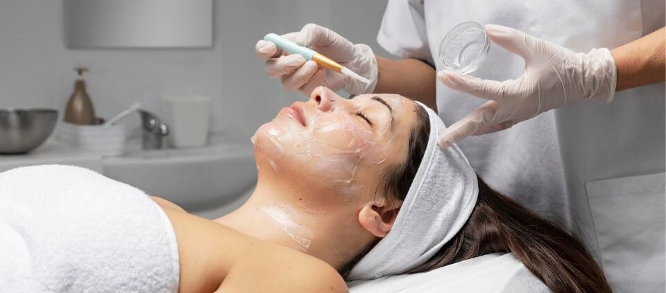 peeling químico facial